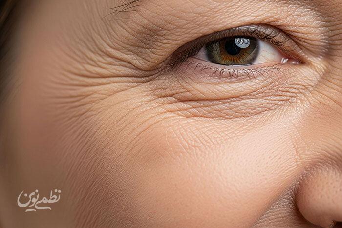 این اشتباه غذایی پوست را پیر میکند