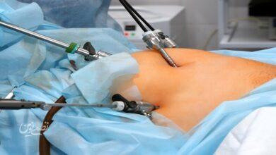 این روش درمان چاقی سلامتی شما را تهدید میکند