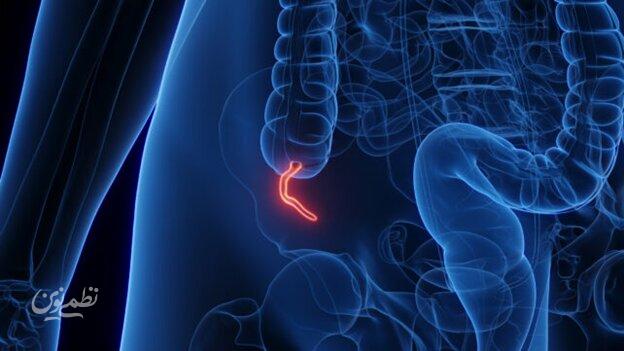 شیوع یک بیماری نادر میان جوانان پزشکان را نگران کرده