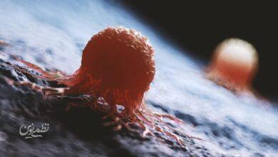 غذاهای ناسالمی که خطر ابتلا به این بیماری هولناک را افزایش میدهند