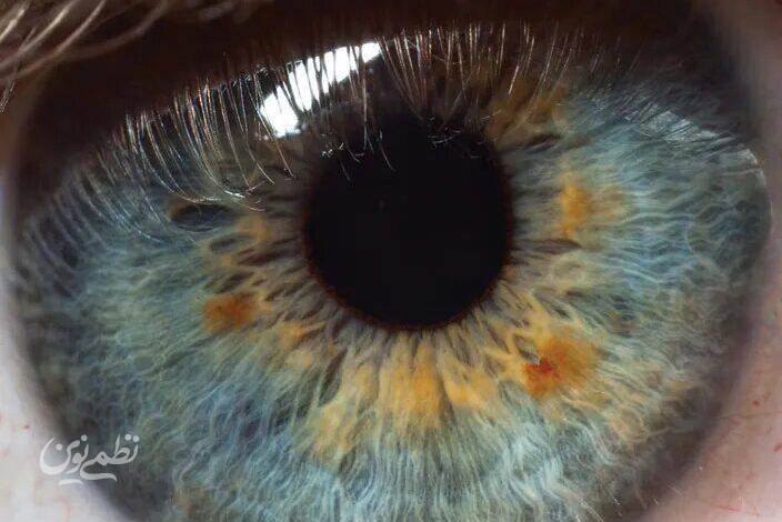 PUPIL