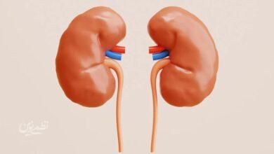 kidney