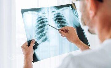 چرا آنفلوآنزا گاهی کشنده میشود؟