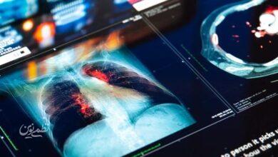 بیماری - سرطان - سلامت