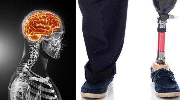 ماجرای مردی که از پزشکان خواست دو انگشتش را قطع کنند