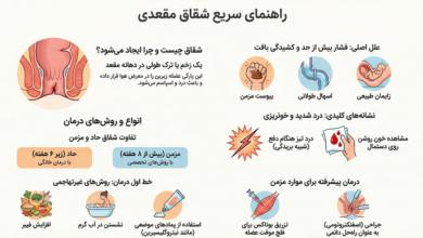 شقاق مقعدی