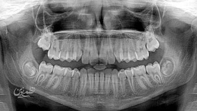dental xray