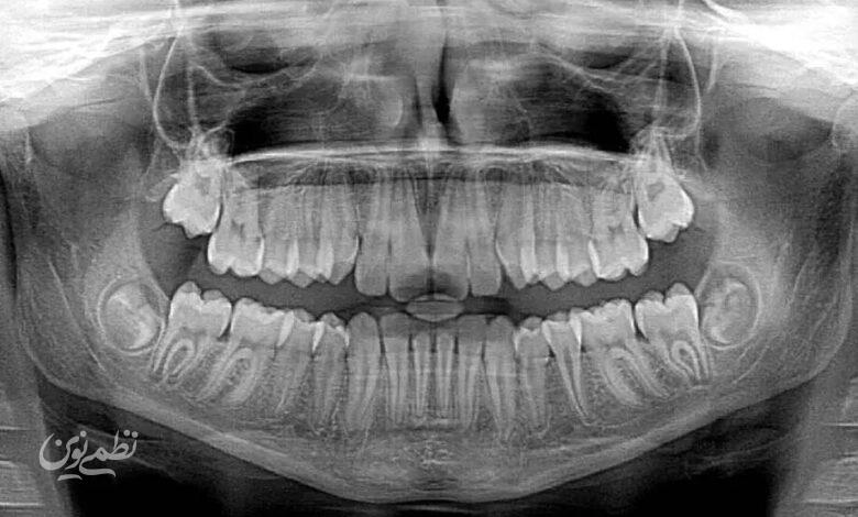 dental xray