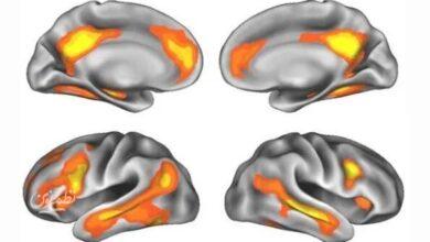 brain