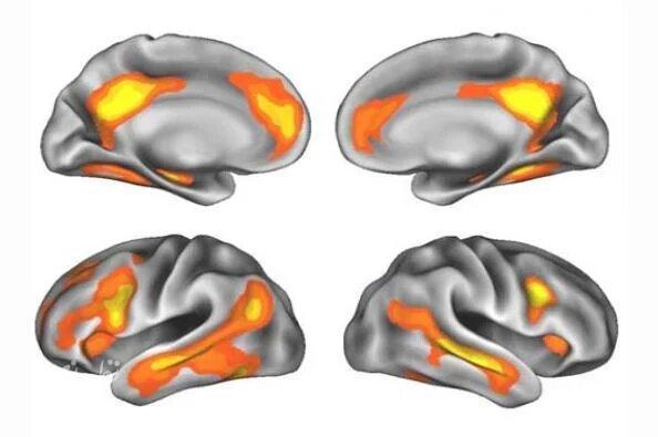 brain