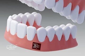پایان معاینه صرف بصری؟ فناوری جدید برای رصد زودهنگام بیماری لثه