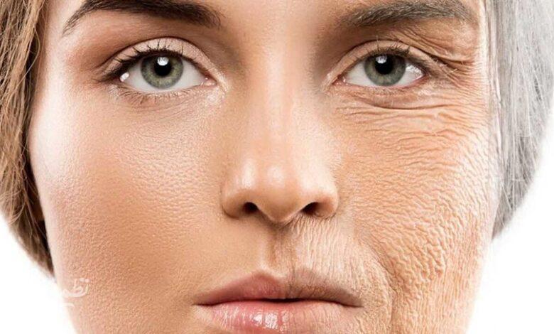 پوستمان را چطور جوان نگهداریم؟