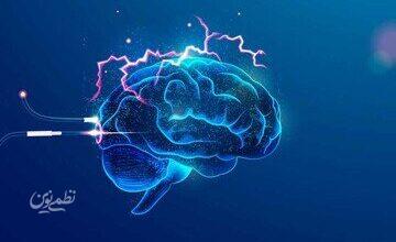 brain