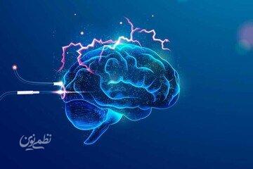 brain