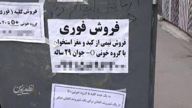 فروش اعضای بدن - دلالی اعضای بدن