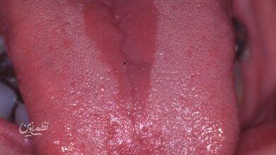 tongue
