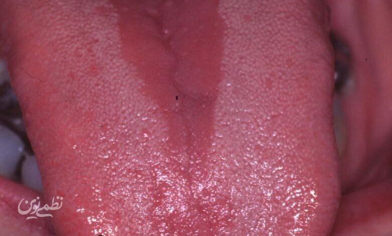 tongue