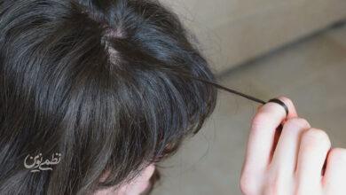 trichotillomania