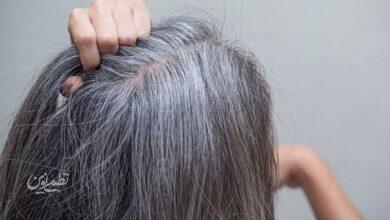راهکاری برای جلوگیری از سفیدی مو وجود دارد؟