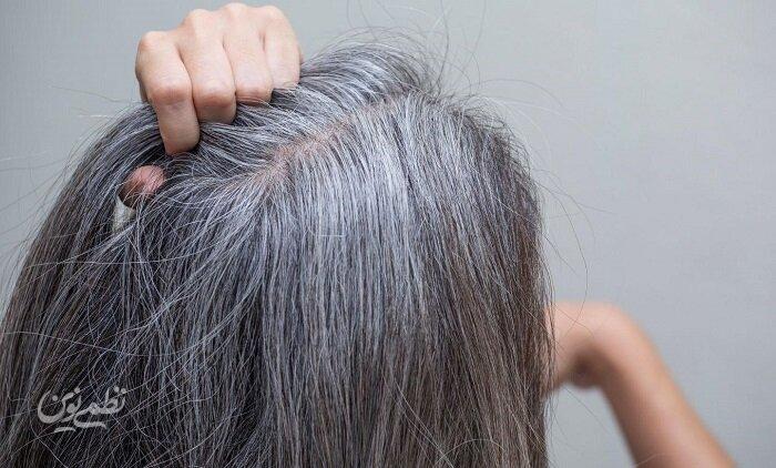 راهکاری برای جلوگیری از سفیدی مو وجود دارد؟