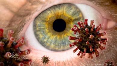 eye