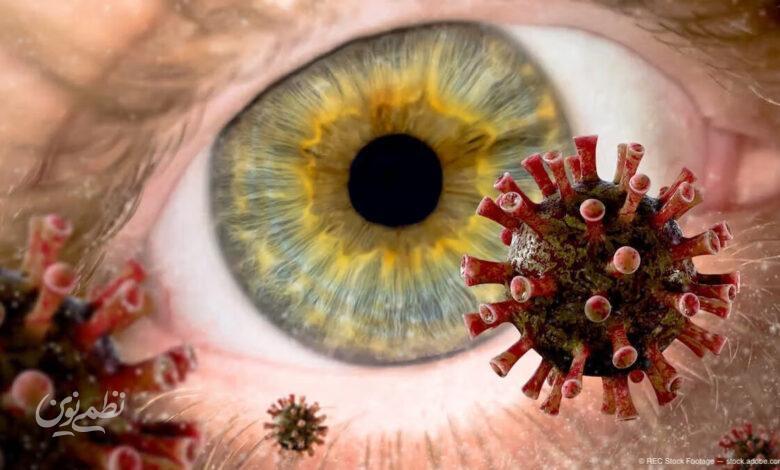 eye
