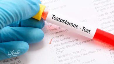 testosterone