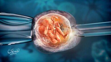 IVF
