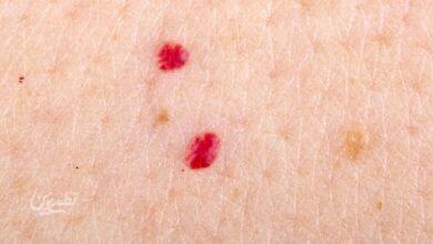red dots