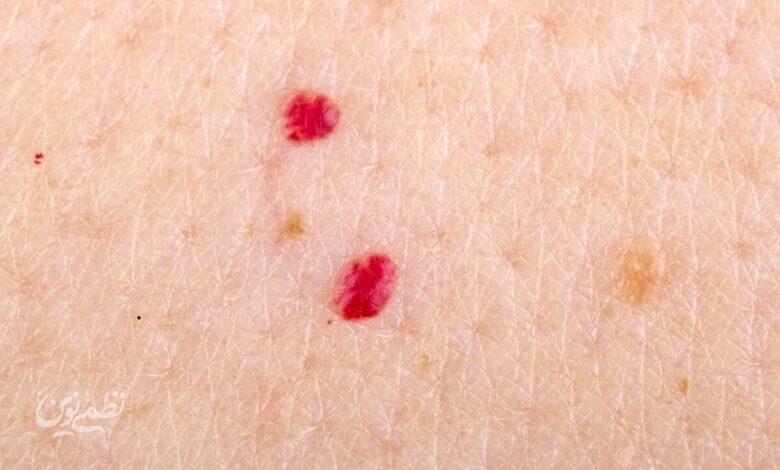 red dots