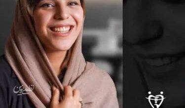 نمونه عکس ارتودنسی نامرئی کلینیک دندانپزشکی دکتر محمدرضا بدیعی