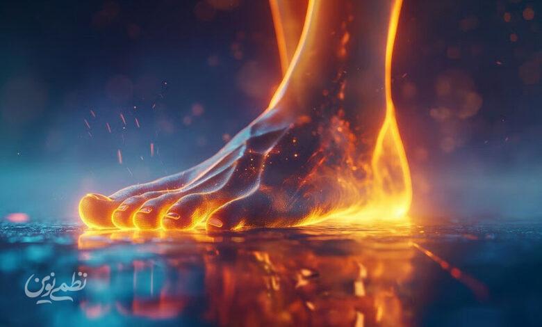 neuropathy